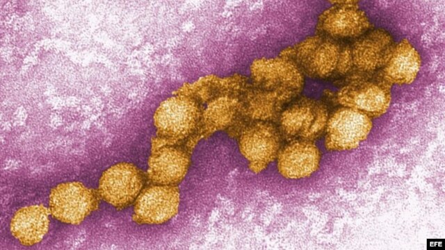 Un micrográfico electrónico del virus del Nilo (Centro para el Control de Enfermedades)