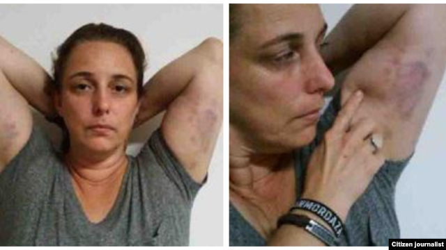 Reporta Cuba. Tania Bruguera, víctima de la represión castrista, 7 de junio. Foto: Ailer González.