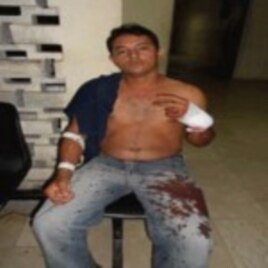 Activista Werlando Leyva agredido a machetazos en Holguín