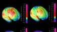 Combo de imágenes que muestran el progreso de maduración del cerebro. 