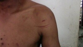 Fariñas, golpeado por paramilitares.