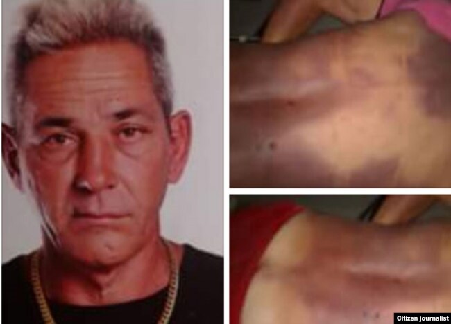 Alejandro Pupo Echemendía y fotos tomadas por sus familiares con las huellas del ataque sufrido en la celda.